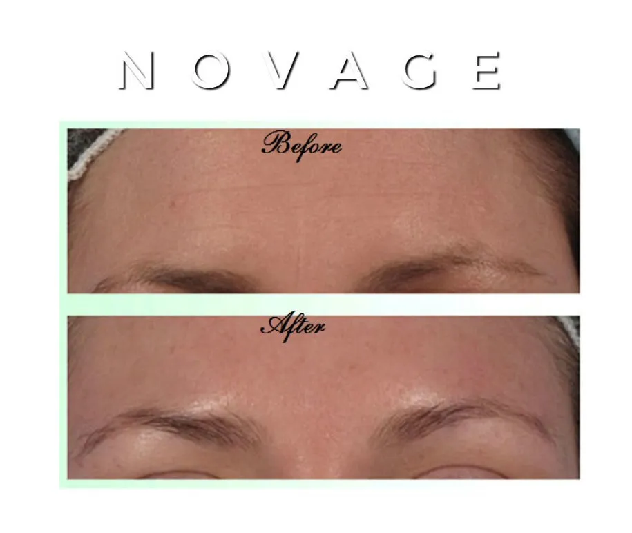 Novage Anti-Aging Cream - MQO 12 pcs